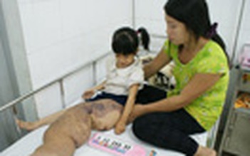 Bệnh viện Nhi đồng 2 hội chẩn cho bé “chân voi”